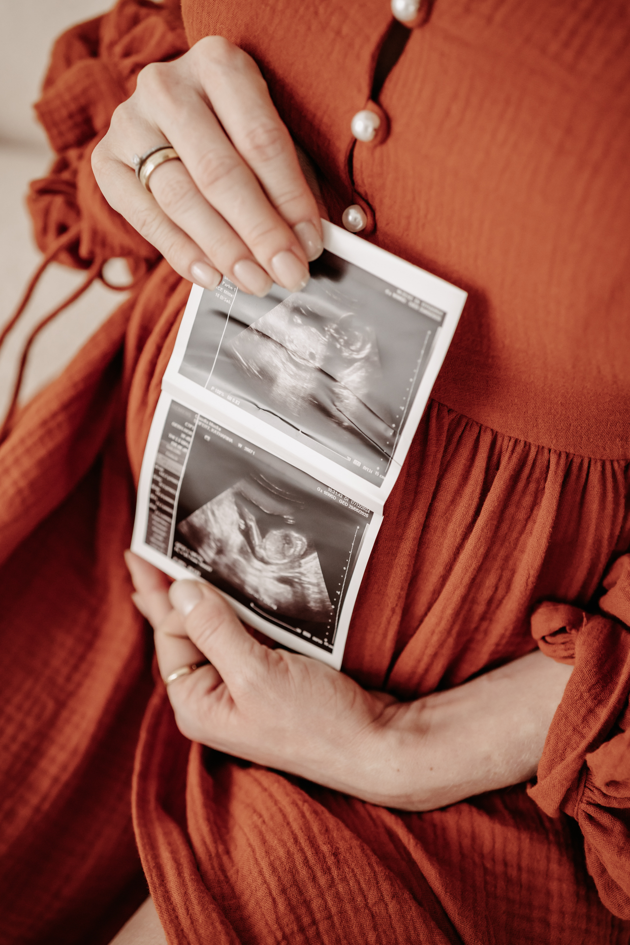 Babybauchfotografie, Newbornfotografie, Famielienfotografie, Mönchengladbach